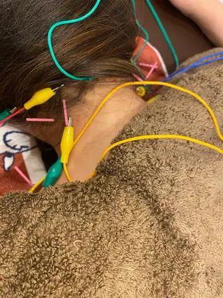 美容鍼灸Solana所属・肌質改善×美容鍼 ゆいのエステ・リラクイメージ