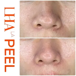 ハーブピーリング専門 BIOEL横浜のエステ・リラクイメージ