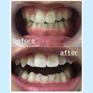 メンズ お手軽ホワイトニングsalon mina所属・武元 奈津美のその他イメージ