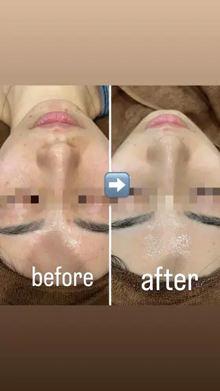 セミロング カラー パーマ ヘアアレンジ メンズ キッズ ネイル マツエク・マツパ アイブロウ Amaryllis 🌹松本のエステ・リラクイメージ