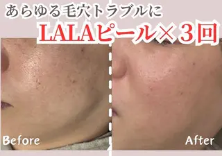 sii センター北 AIのエステ・リラクイメージ