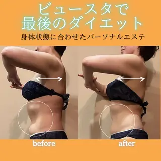 痩身&美肌サロン ビュースタ 伊藤🌷のエステ・リラクイメージ