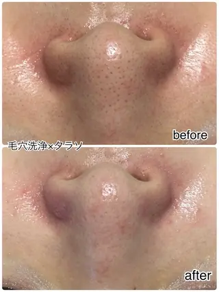 ENCHANT Kaede/肌質改善のその他イメージ