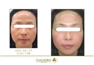 肌質改善サロン renew所属・肌質改善サロン renew/ウエキのエステ・リラクイメージ