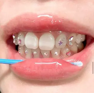 ホワイトニングショップ伊丹店所属・ホワイトニング ショップ伊丹店のその他イメージ