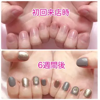 ネイル 深爪を断らない スカルプ高評価店のネイルデザイン