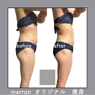 marron所属・痩身ハイパーナイフ ララピールリアボーテのエステ・リラクイメージ