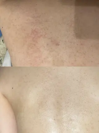 re.make所属・美肌/小顔☃️ ユキナ🤍のネイルデザイン