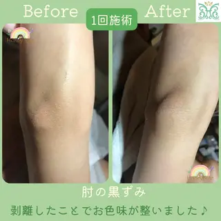 剥離するハーブ🌈 Honey Sideのエステ・リラクイメージ