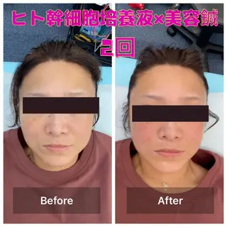 gomi sayakaのエステ・リラクイメージ