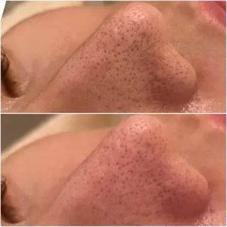 ✨美肌水光✨ アトリエリュバンのエステ・リラクイメージ