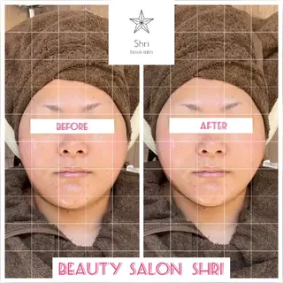 salon Lewis Addict所属・ルイスアディクト 名駅店のエステ・リラクイメージ