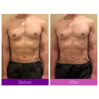 ☆痩身/小顔☆ 結果出します☆のエステ・リラクイメージ