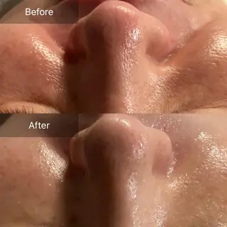 Mandarin Orange所属・毛穴から始める肌メン テマンダリンオレンジのエステ・リラクイメージ