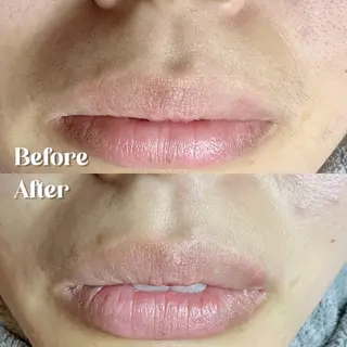 Hit. シュガーリング豊橋のエステ・リラクイメージ