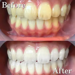 ネイル マツエク・マツパ アイブロウ メンズ ヘアアレンジ LBSホワイトニング 銀座店💎店長浦和のその他イメージ