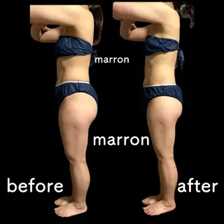 marron所属・痩身ハイパーナイフ ララピールリアボーテのエステ・リラクイメージ