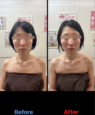 毛穴改善/脱毛 ネイル 川上久仁子のエステ・リラクイメージ