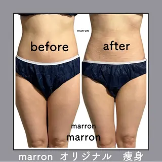 marron所属・痩身ハイパーナイフ ララピールリアボーテのエステ・リラクイメージ