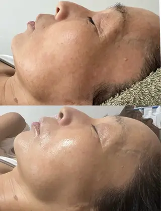 Beauty Salon Adiy所属・Adiy ikumiのエステ・リラクイメージ