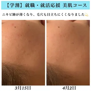 Bellesthe （ベルエステ）のエステ・リラクイメージ