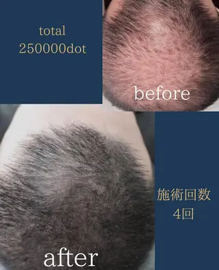 メンズ W eye+東口店/ SCALP INKのマツエク・マツパデザイン