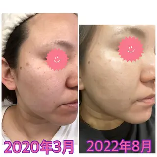 肌育脱毛サロン LikoLinaのその他イメージ