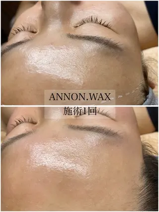 肌質改善ワックス専門 yukiのエステ・リラクイメージ