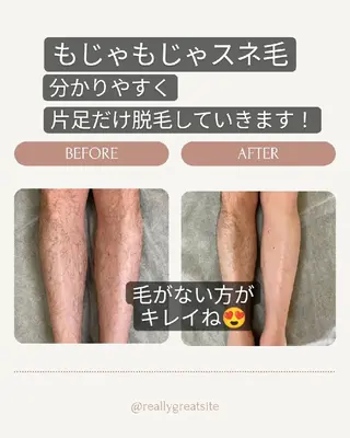 プライベートサロン宿り木所属・江坂@宿り木　脱毛＆ 耳ツボジュエリーのその他イメージ