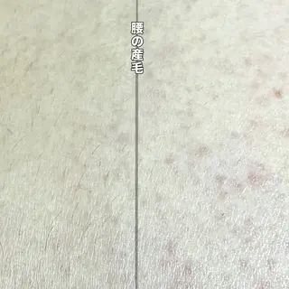 Hit. シュガーリング豊橋のエステ・リラクイメージ