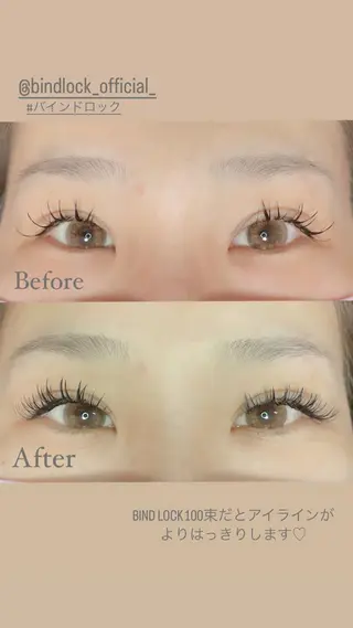 ใใใจใฏใปใใใ ๐๐ผ๐๐๐ ๐๐ธ๐โใฎใใใจใฏใปใใใใใถใคใณ