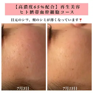 Bellesthe (ベルエステ)のエステ・リラクイメージ