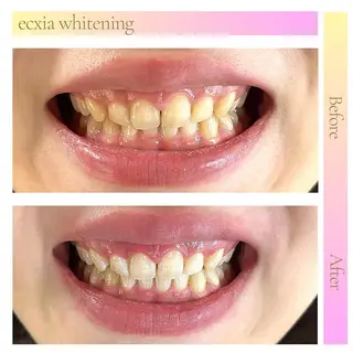 セルフホワイトニング エクシア東上野店のその他イメージ