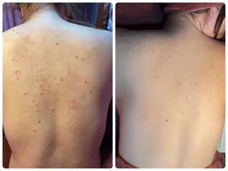 ニキビ、痩身、脱毛、 サクラチャンスパのエステ・リラクイメージ