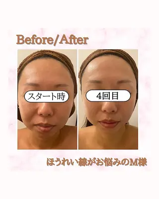 痩身リラク専門サロン 〜LUCIALL 〜のエステ・リラクイメージ