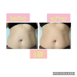 癒し腸もみサロン シャユーム　ゆきなのエステ・リラクイメージ