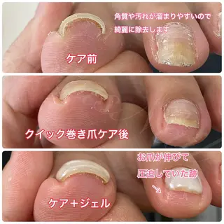 ネイル Lotus Nailのネイルデザイン