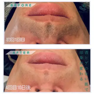 メンズ キッズ メンズ&レディース　Bell style所属・【脱毛・美肌専門】 bellstyleのエステ・リラクイメージ