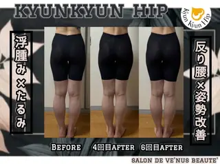 ヴィーナス ビューティーのエステ・リラクイメージ