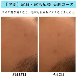 Bellesthe （ベルエステ）のエステ・リラクイメージ