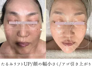 頭蓋骨小顔コルギPerm所属・頭蓋骨小顔コルギ Permのその他イメージ