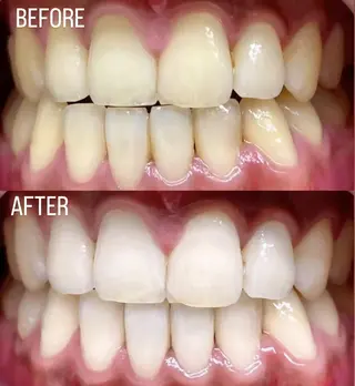 LBSホワイトニング 銀座店💎店長浦和のその他イメージ