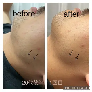 ENCHANT 脱毛.小顔.毛穴のエステ・リラクイメージ