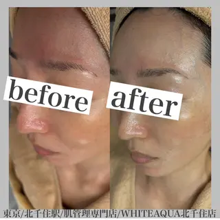 WHITE AQUA 北千住店のエステ・リラクイメージ