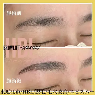 アイブロウ epismoo 脱毛/HBL/毛穴の眉毛・アイブロウイメージ
