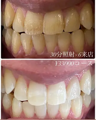 メンズ ホワイトニングルーム　川崎店所属・ホワイトニング ルーム　川崎店のその他イメージ