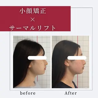 小顔矯正専門店 ❤️池田 桃花のエステ・リラクイメージ