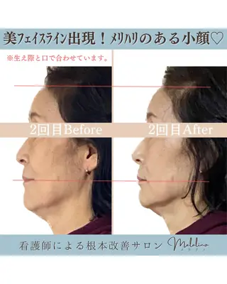 美容整体サロン Melalinoのエステ・リラクイメージ