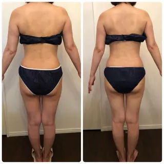 FLEUR大阪・美容 整体・痩身・小顔のエステ・リラクイメージ