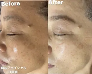 メンズ Epina 千葉店 【エピナ】のエステ・リラクイメージ